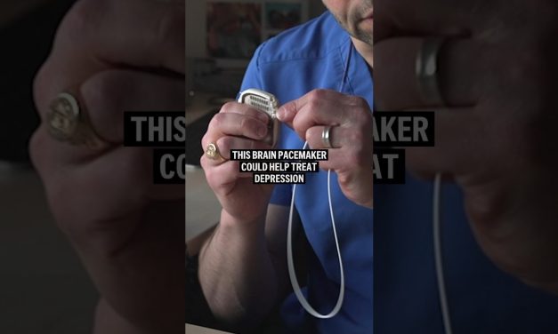 Brain Pacemaker Dapat Mengobati Berbagai Gangguan Neurologis