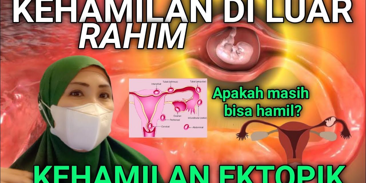 Kehamilan Di Luar Rahim Sering Terjadi Pada Awal Pernikahan