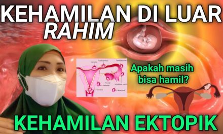 Kehamilan Di Luar Rahim Sering Terjadi Pada Awal Pernikahan