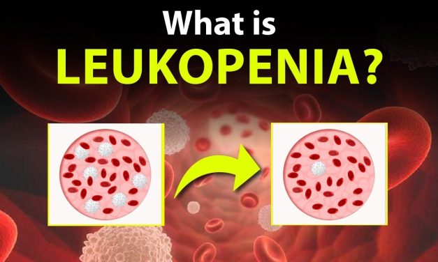 Leukopenia : Kondisi Rendahnya Sel Darah Putih Dalam Tubuh