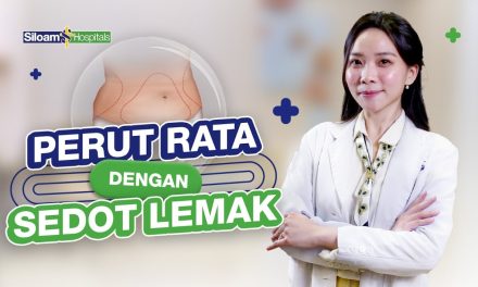 Tindakan Sedot Lemak : Metode Untuk Mendapatkan Tubuh Ideal