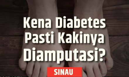 Tindakan Amputasi Bukan Akhir Dari Perjuangan Hidupan Anda Lo!