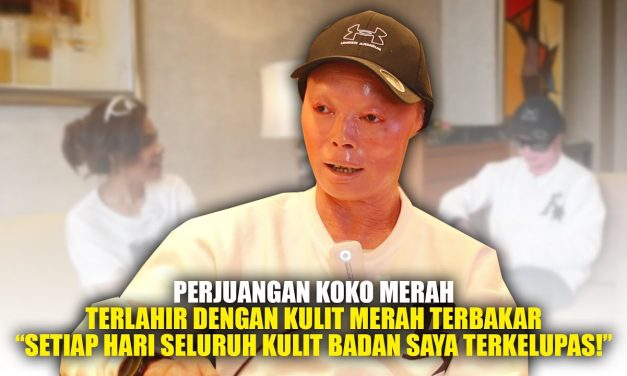 Koko Merah Tetap Semangat Meskipun Menderita Penyakit Langka