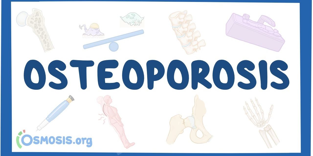 Osteoporosis Menyebabkan Tulang Menjadi Mudah Patah