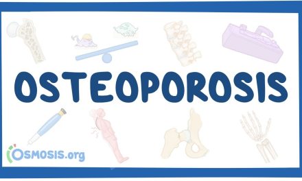 Osteoporosis Menyebabkan Tulang Menjadi Mudah Patah