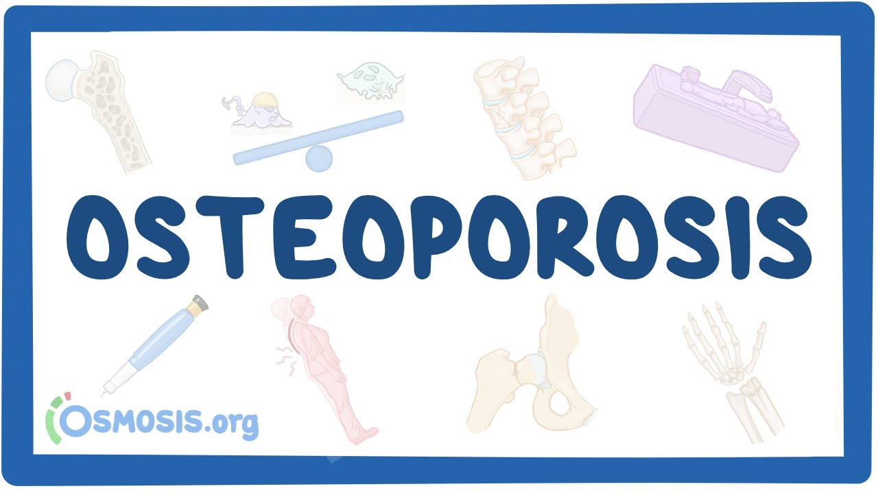 Osteoporosis
