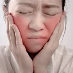 Cek Gejala Lupus: Kenali Tandanya Sebelum Terlambat