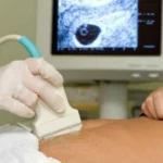 Kata Dokter, Ini 6 Syarat Aman Puasa Saat Hamil