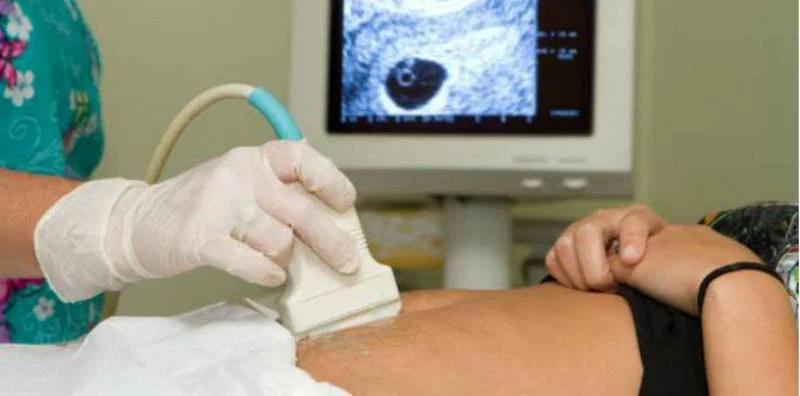 Kata Dokter, Ini 6 Syarat Aman Puasa Saat Hamil