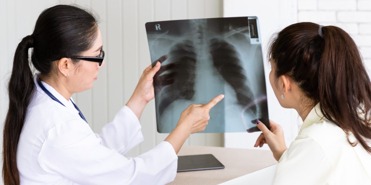 Kata Dokter Paru: Cara Sembuh TBC Yang Bener