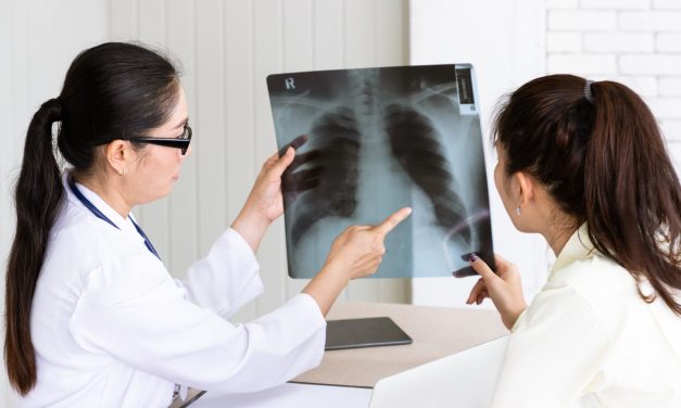 Kata Dokter Paru: Cara Sembuh TBC Yang Bener