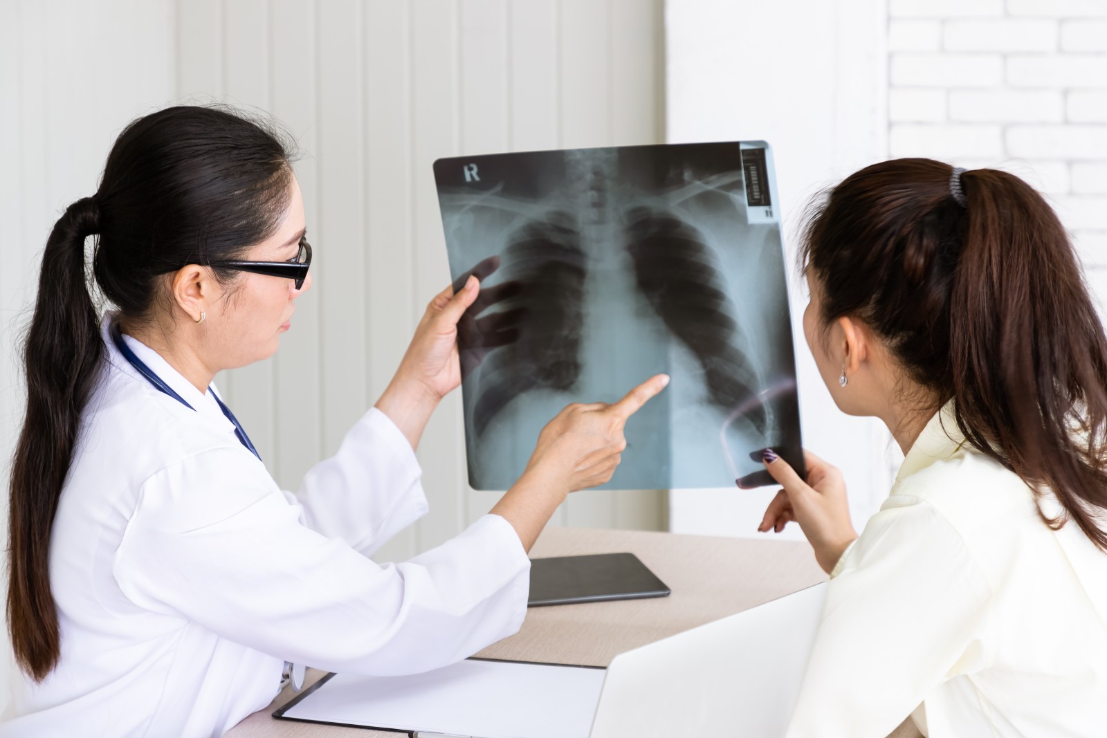 Kata Dokter Paru: Cara Sembuh TBC Yang Bener
